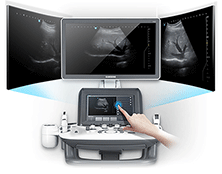 최상급 초음파 진단기